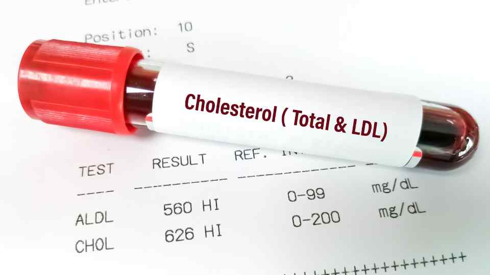 check your cholesterol levels